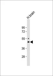 Anti-Kir2.1 antibody, C-term used in Western Blot (WB). GTX81647