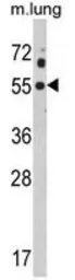 Anti-Kir2.1 antibody, C-term used in Western Blot (WB). GTX81647