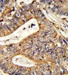 Anti-Calreticulin antibody, Internal used in IHC (Paraffin sections) (IHC-P). GTX81663