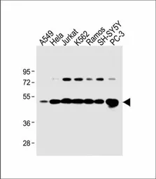 Anti-Calreticulin antibody, Internal used in Western Blot (WB). GTX81663
