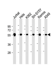 Anti-Calreticulin antibody, Internal used in Western Blot (WB). GTX81663