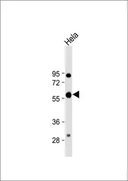 Anti-Calreticulin antibody, Internal used in Western Blot (WB). GTX81663