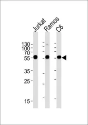 Anti-Calreticulin antibody, Internal used in Western Blot (WB). GTX81663