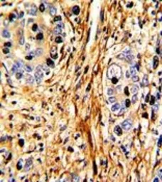 Anti-Laminin beta 2 antibody, C-term used in IHC (Paraffin sections) (IHC-P). GTX81697