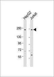 Anti-Laminin beta 2 antibody, C-term used in Western Blot (WB). GTX81697