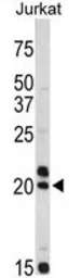 Anti-VIP antibody, C-term used in Western Blot (WB). GTX81846