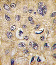 Anti-TSC2 antibody used in IHC (Paraffin sections) (IHC-P). GTX81899