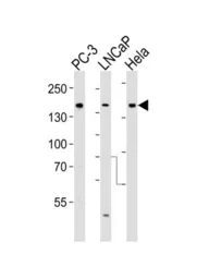 Anti-TSC2 antibody used in Western Blot (WB). GTX81899