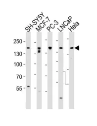 Anti-TSC2 antibody used in Western Blot (WB). GTX81899