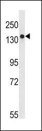 Anti-TSC2 antibody used in Western Blot (WB). GTX81899