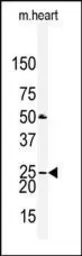 Anti-Claudin 2 antibody, N-term used in Western Blot (WB). GTX81901