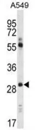 Anti-Claudin 1 antibody, Loop1 used in Western Blot (WB). GTX81903