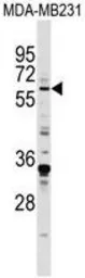 Anti-EGR1 antibody, N-term used in Western Blot (WB). GTX81956