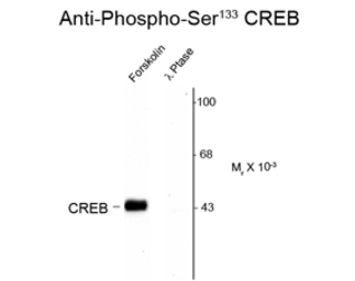 Anti-CREB (phospho Ser133) antibody used in Western Blot (WB). GTX82716