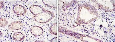 Anti-E-Cadherin antibody [7H12] used in IHC (Paraffin sections) (IHC-P). GTX82753