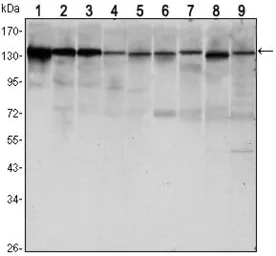 Anti-E-Cadherin antibody [7H12] used in Western Blot (WB). GTX82753