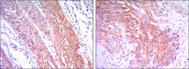 Anti-Hexokinase II antibody [3D3] used in IHC (Paraffin sections) (IHC-P). GTX82791