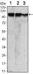 Anti-Hexokinase II antibody [3D3] used in Western Blot (WB). GTX82791