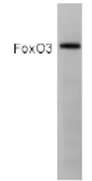 Anti-FOXO3A antibody used in Western Blot (WB). GTX82877