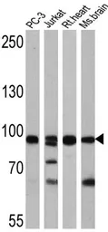 Anti-FOXO3A antibody used in Western Blot (WB). GTX82877