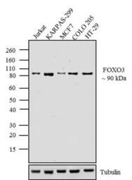 Anti-FOXO3A antibody used in Western Blot (WB). GTX82877