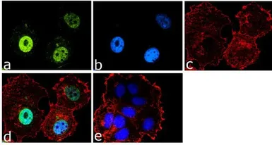 Anti-FOXO3A antibody used in Immunocytochemistry/ Immunofluorescence (ICC/IF). GTX82877