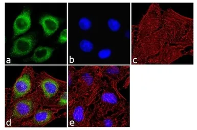 Anti-IP3 Receptor I antibody used in Immunocytochemistry/ Immunofluorescence (ICC/IF). GTX82887