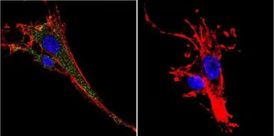 Anti-KCNQ2 antibody used in Immunocytochemistry/ Immunofluorescence (ICC/IF). GTX82891