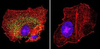 Anti-KCNQ2 antibody used in Immunocytochemistry/ Immunofluorescence (ICC/IF). GTX82891