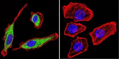 Anti-KCNQ2 antibody used in Immunocytochemistry/ Immunofluorescence (ICC/IF). GTX82891