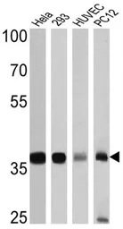 Anti-GAPDH antibody used in Western Blot (WB). GTX82899