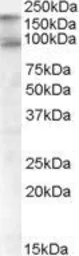 Anti-CDCP1 (isoform 1: C term) antibody, C-term used in Western Blot (WB). GTX82973