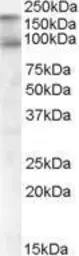 Anti-CDCP1 (isoform 1: C term) antibody, C-term used in  (). GTX82973