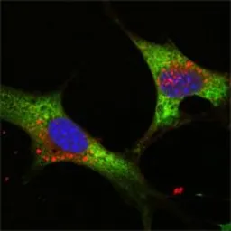 Anti-Lin28A antibody [6D1F9] used in Immunocytochemistry/ Immunofluorescence (ICC/IF). GTX83162