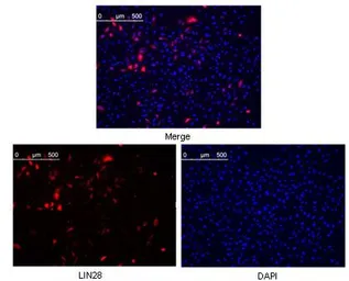 Anti-Lin28A antibody [6D1F9] used in Immunocytochemistry/ Immunofluorescence (ICC/IF). GTX83162