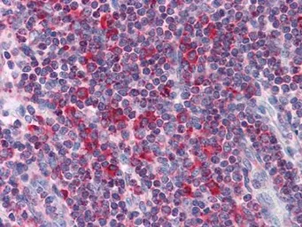 Anti-LYRIC antibody [2F11C3] used in IHC (Paraffin sections) (IHC-P). GTX83259