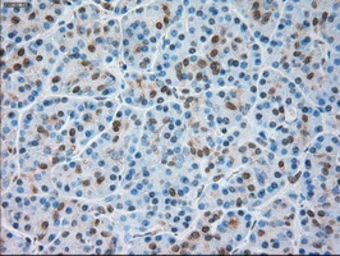 Anti-TRPM4 antibody [10H5] used in IHC (Paraffin sections) (IHC-P). GTX83489