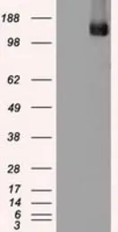 Anti-TRPM4 antibody [10H5] used in Western Blot (WB). GTX83489