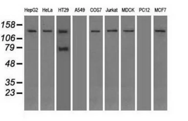 Anti-TRPM4 antibody [10H5] used in Western Blot (WB). GTX83489