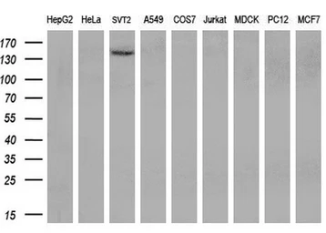 Anti-TRPM4 antibody [3C4] used in Western Blot (WB). GTX83490