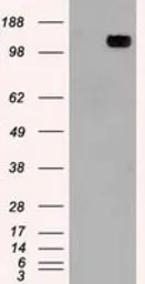 Anti-TRPM4 antibody [3C4] used in Western Blot (WB). GTX83490