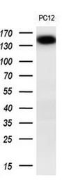 Anti-TRPM4 antibody [14C3] used in Western Blot (WB). GTX83491