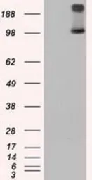 Anti-TRPM4 antibody [14C3] used in Western Blot (WB). GTX83491