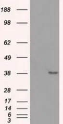 Anti-Sorbitol Dehydrogenase antibody [9E7] used in Western Blot (WB). GTX83589