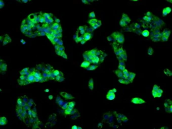 Anti-Sorbitol Dehydrogenase antibody [9E7] used in Immunocytochemistry/ Immunofluorescence (ICC/IF). GTX83589