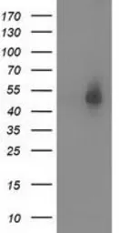 Anti-Syntrophin alpha 1 antibody [1H10] used in Western Blot (WB). GTX83607