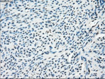 Anti-GLUT5 antibody [14C8] used in IHC (Paraffin sections) (IHC-P). GTX83627