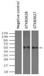 Anti-GLUT5 antibody [14C8] used in Immunoprecipitation (IP). GTX83627