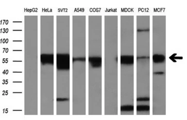 Anti-GLUT5 antibody [14C8] used in Western Blot (WB). GTX83627