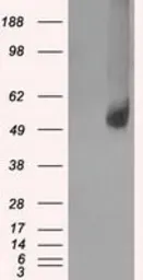 Anti-GLUT5 antibody [14C8] used in Western Blot (WB). GTX83627